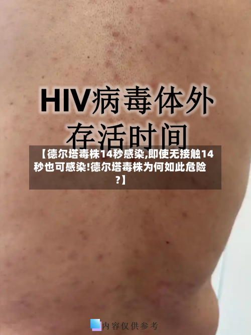 【德尔塔毒株14秒感染,即使无接触14秒也可感染!德尔塔毒株为何如此危险?】