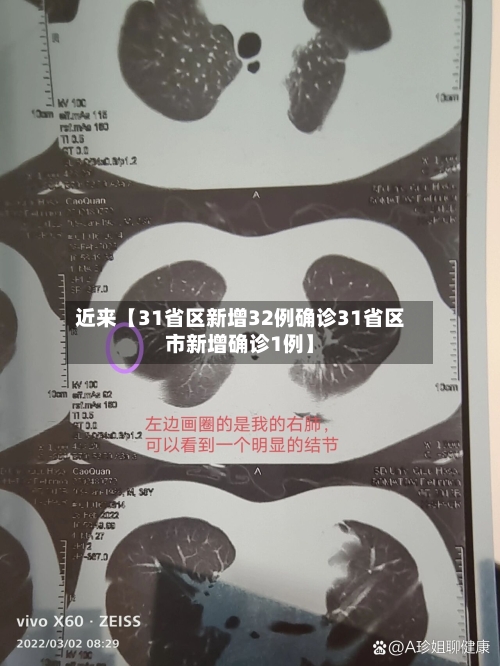 近来【31省区新增32例确诊31省区市新增确诊1例】