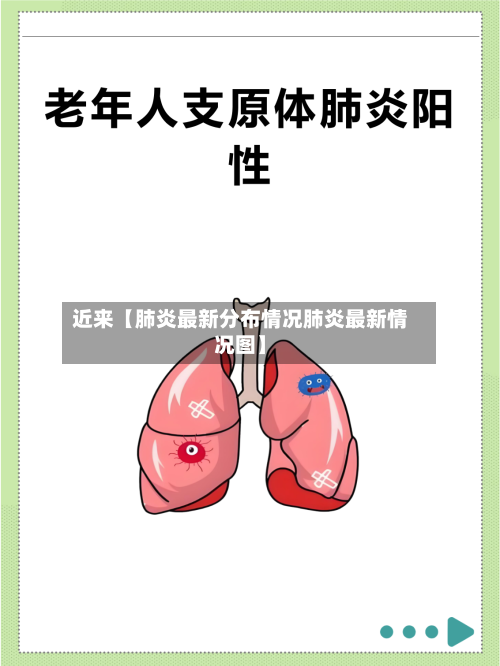 近来【肺炎最新分布情况肺炎最新情况图】