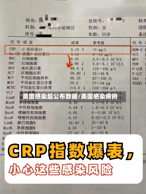 美国感染超公布数据/美国感染病例