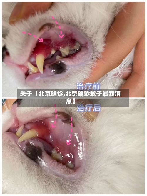 关于【北京确诊,北京确诊蚊子最新消息】